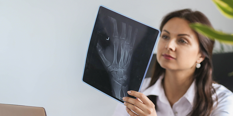 Osteoporosis
